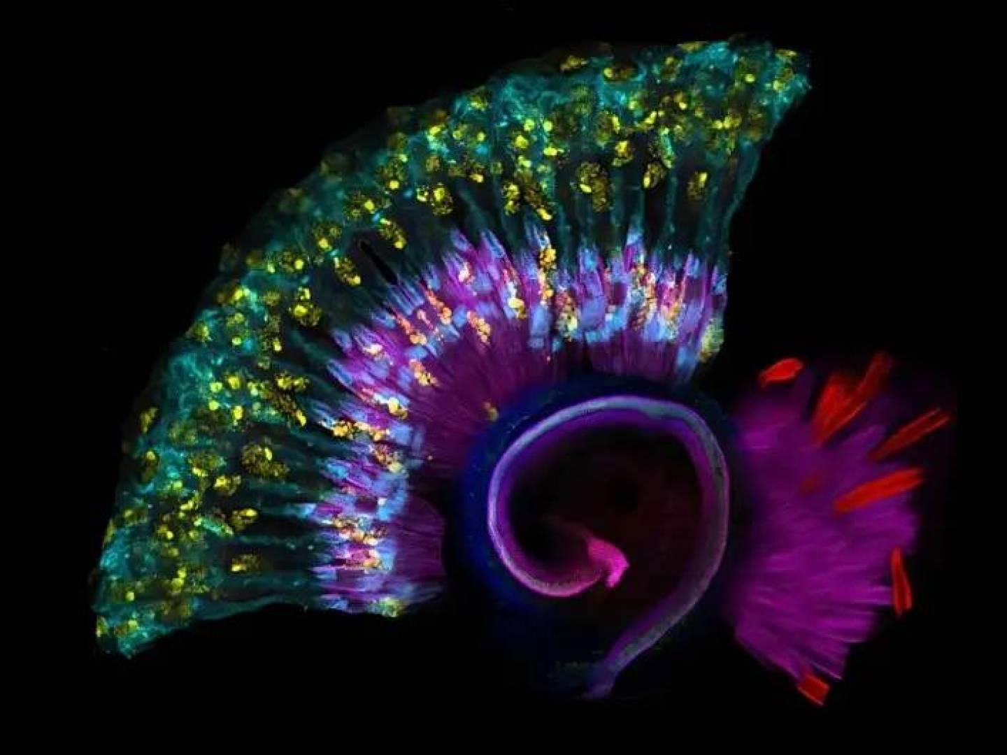 Discovery of a new genetic mutation that causes deafness