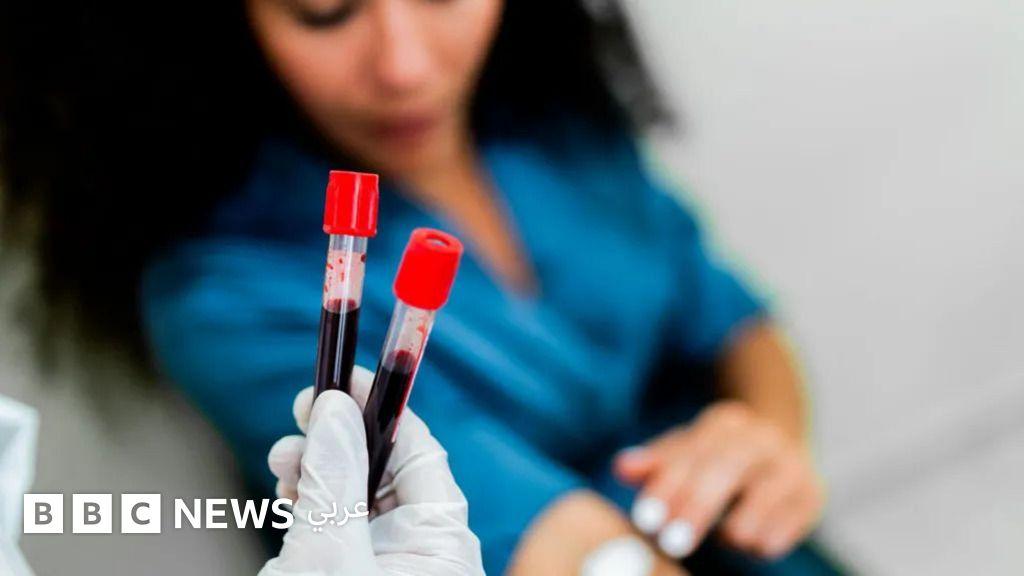 نتائج مشجعة لفحص الدم للكشف عن أكثر من 50 نوعا من السرطان – عرب نيوز