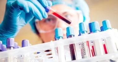 ردًا على الأورام الصلبة.. علماء يطورون علاجًا لسرطان البنكرياس - اليوم السابع